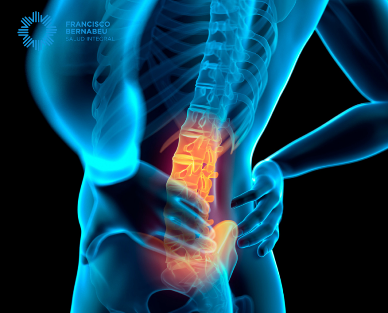 Tratamiento del dolor lumbar en Clínica Francisco Bernabéu